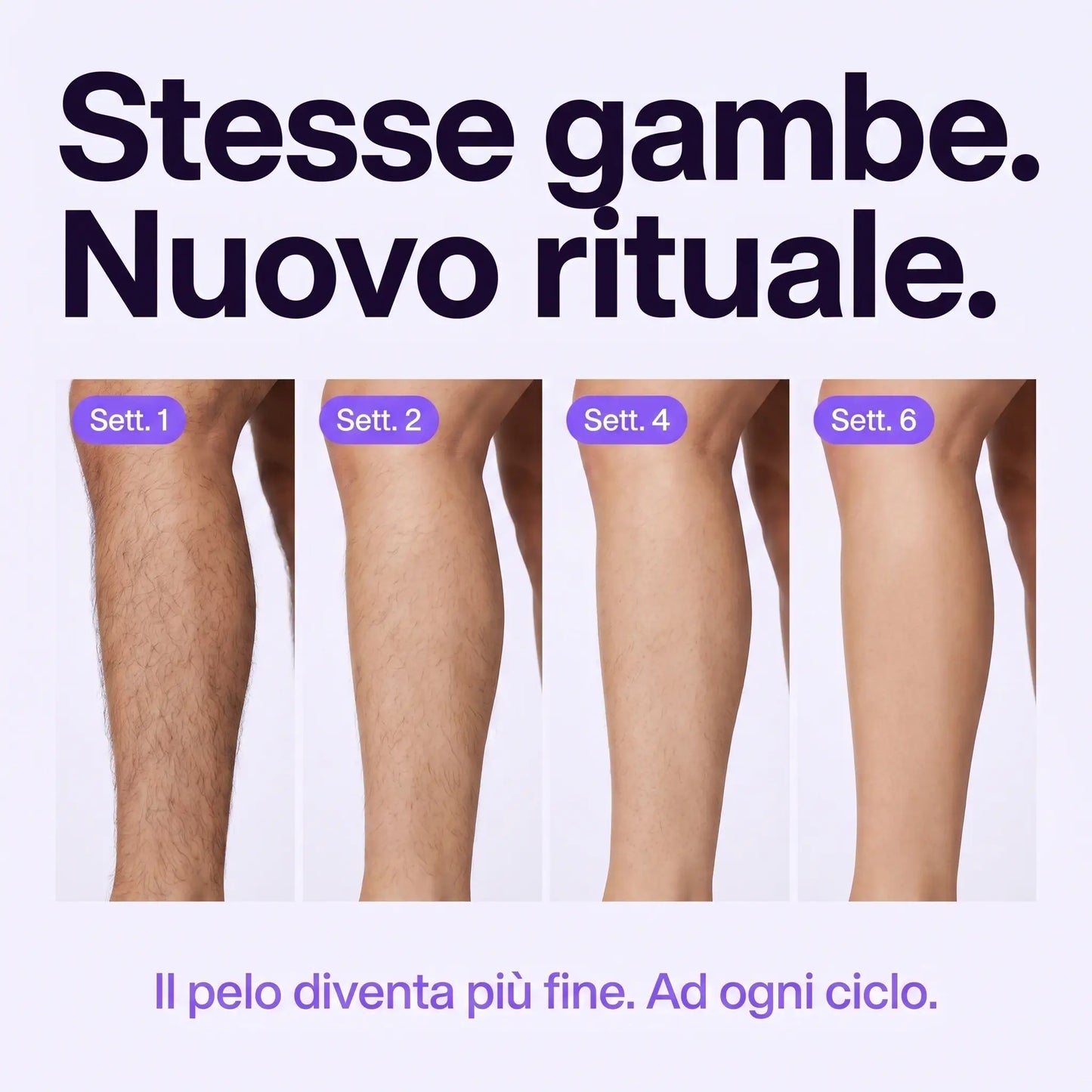KEPHRI™ - Il Siero che Rallenta la Ricrescita dei Peli Dopo Ogni Applicazione