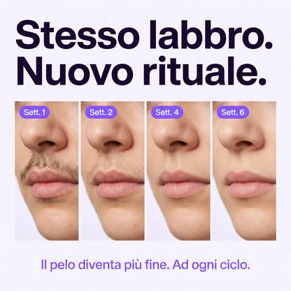 KEPHRI™ - Il Siero che Rallenta la Ricrescita dei Peli del Viso Dopo Ogni Applicazione