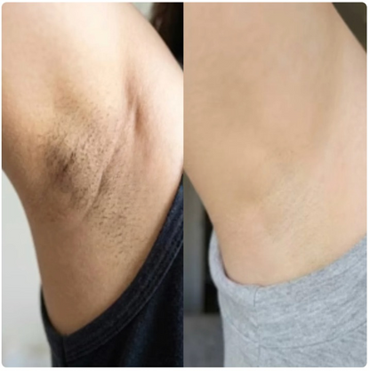 Siero Botanico Anti-Ricrescita